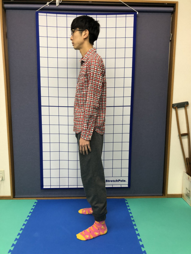 before画像
